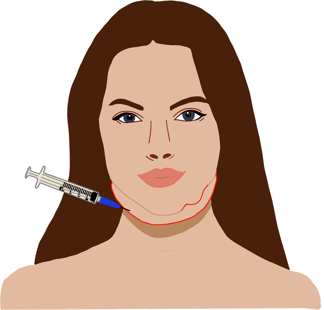 Lipolyse