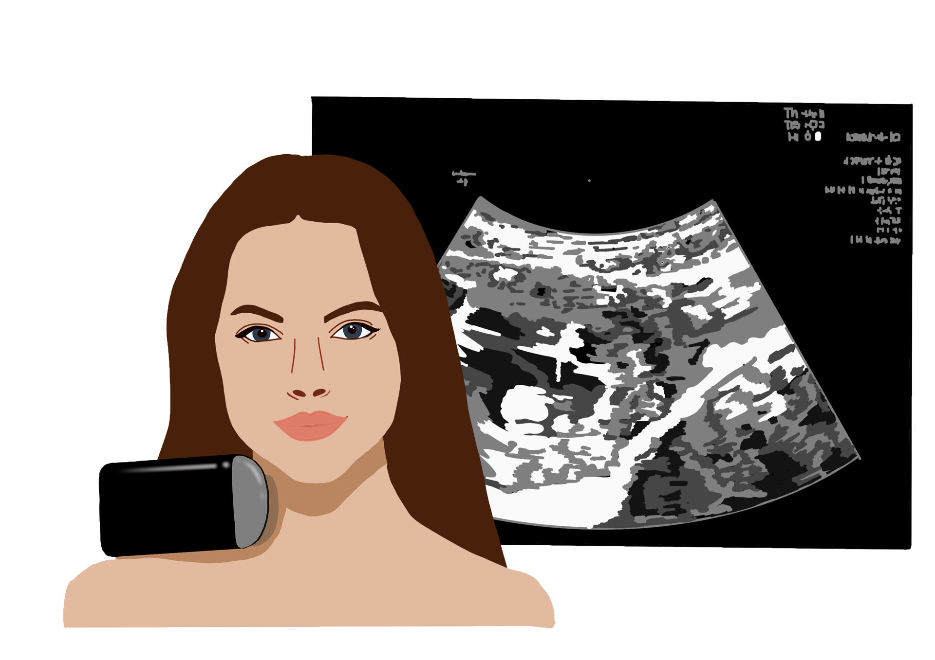 Ultraschall Botulinumtoxin Botox
